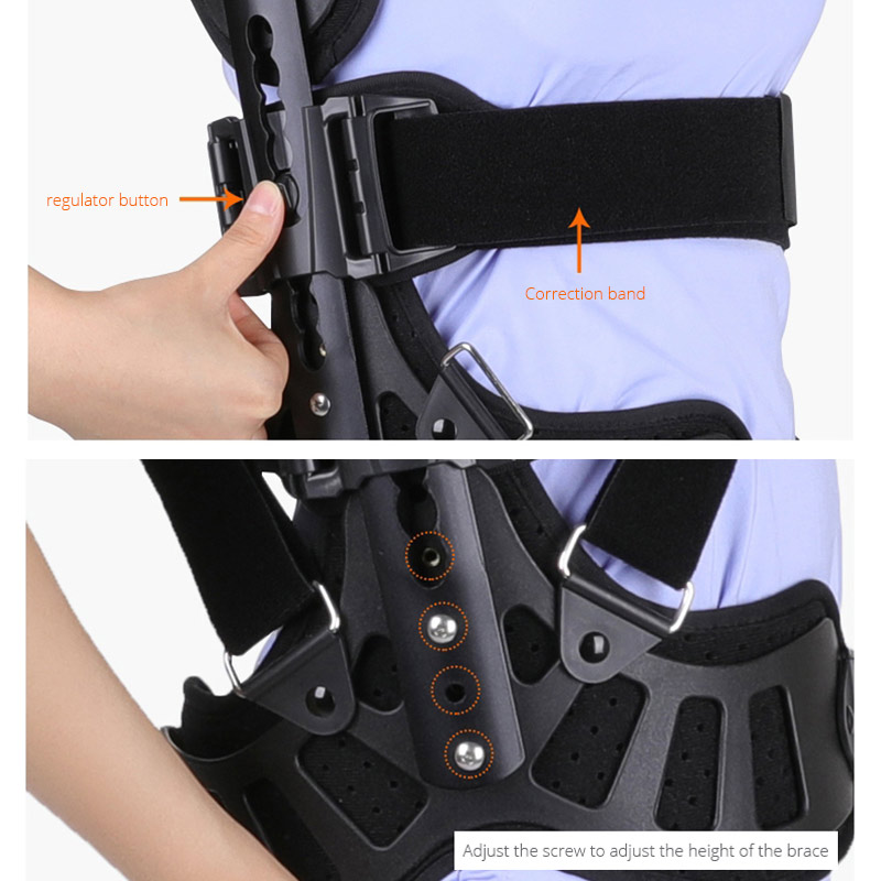 Effective Scoliosis Brace for Adults with Modern Milwaukee Design